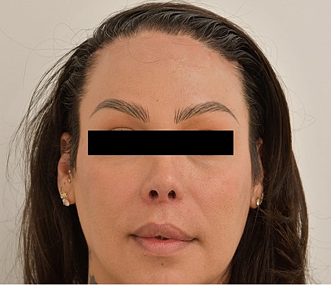 MTF Hair Gallery Before & After