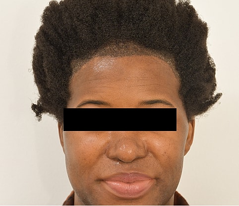 MTF Hair Gallery Before & After