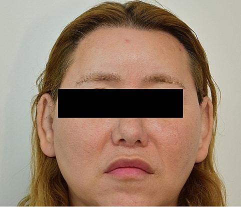 MTF Hair Gallery Before & After