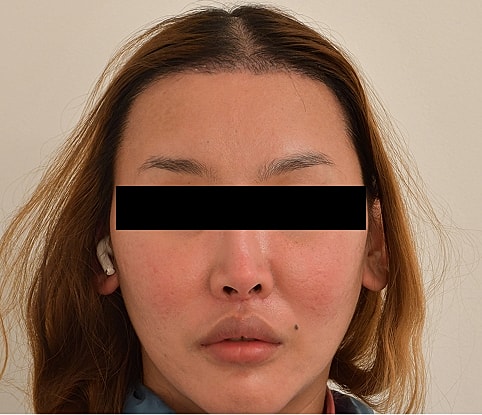 MTF Hair Gallery Before & After