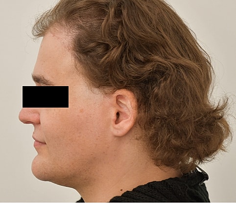 MTF Hair Gallery Before & After