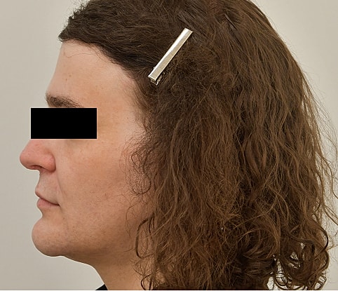 MTF Hair Gallery Before & After