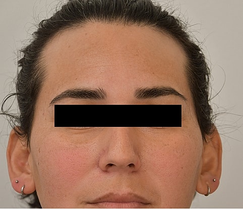 MTF Hair Gallery Before & After