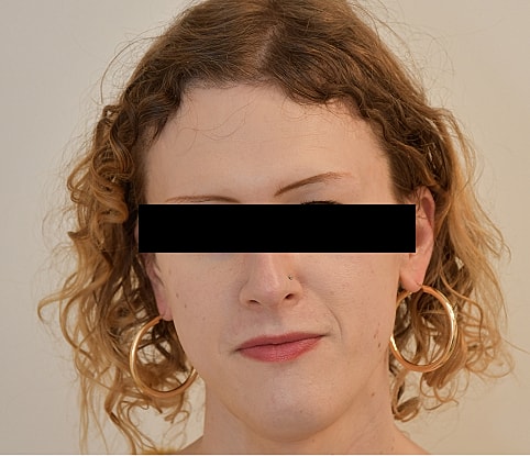 MTF Hair Gallery Before & After