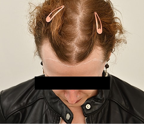 MTF Hair Gallery Before & After