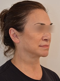 Profile view of a woman with a neutral expression.