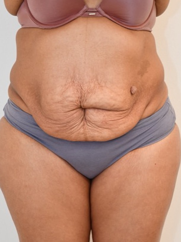 Close-up of middle section of woman's body
