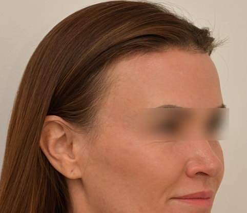 Profile view of a woman with long hair.