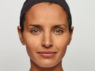 Neurotoxins Before & After