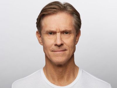 Neurotoxins Before & After