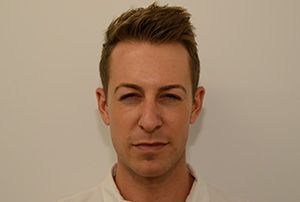 Neurotoxins Before & After