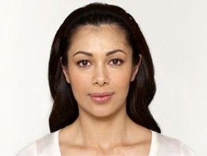 Neurotoxins Before & After