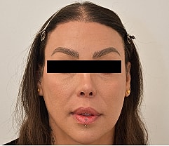 Gender Affirming Hair Before & After