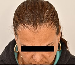 Gender Affirming Hair Before & After