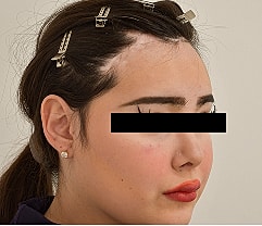 Gender Affirming Hair Before & After