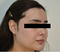 Gender Affirming Hair Before & After