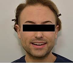 Gender Affirming Hair Before & After