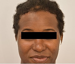 Gender Affirming Hair Before & After