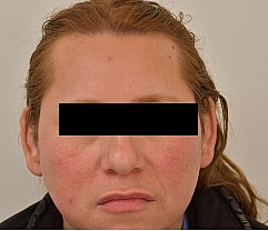 Gender Affirming Hair Before & After