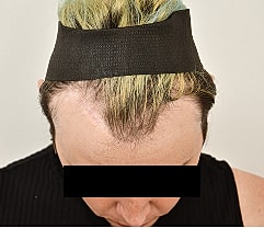 Gender Affirming Hair Before & After