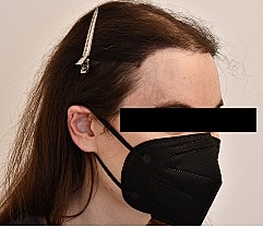 Gender Affirming Hair Before & After