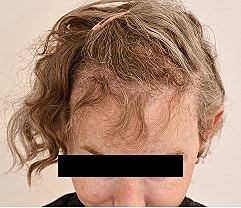 Gender Affirming Hair Before & After