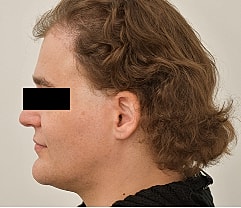 Gender Affirming Hair Before & After