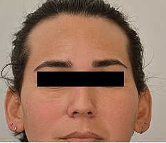 Gender Affirming Hair Before & After