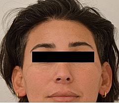 Gender Affirming Hair Before & After