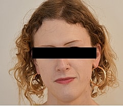 Gender Affirming Hair Before & After