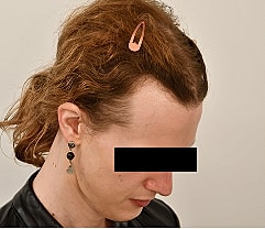 Gender Affirming Hair Before & After