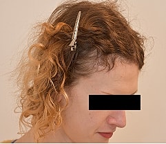 Gender Affirming Hair Before & After