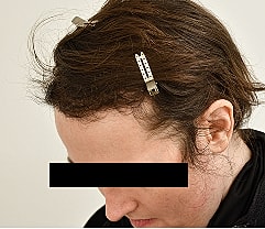 Gender Affirming Hair Before & After