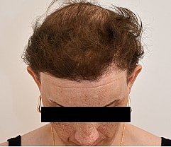 Gender Affirming Hair Before & After