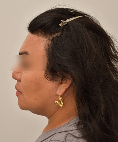 Profile view of a person with long hair.