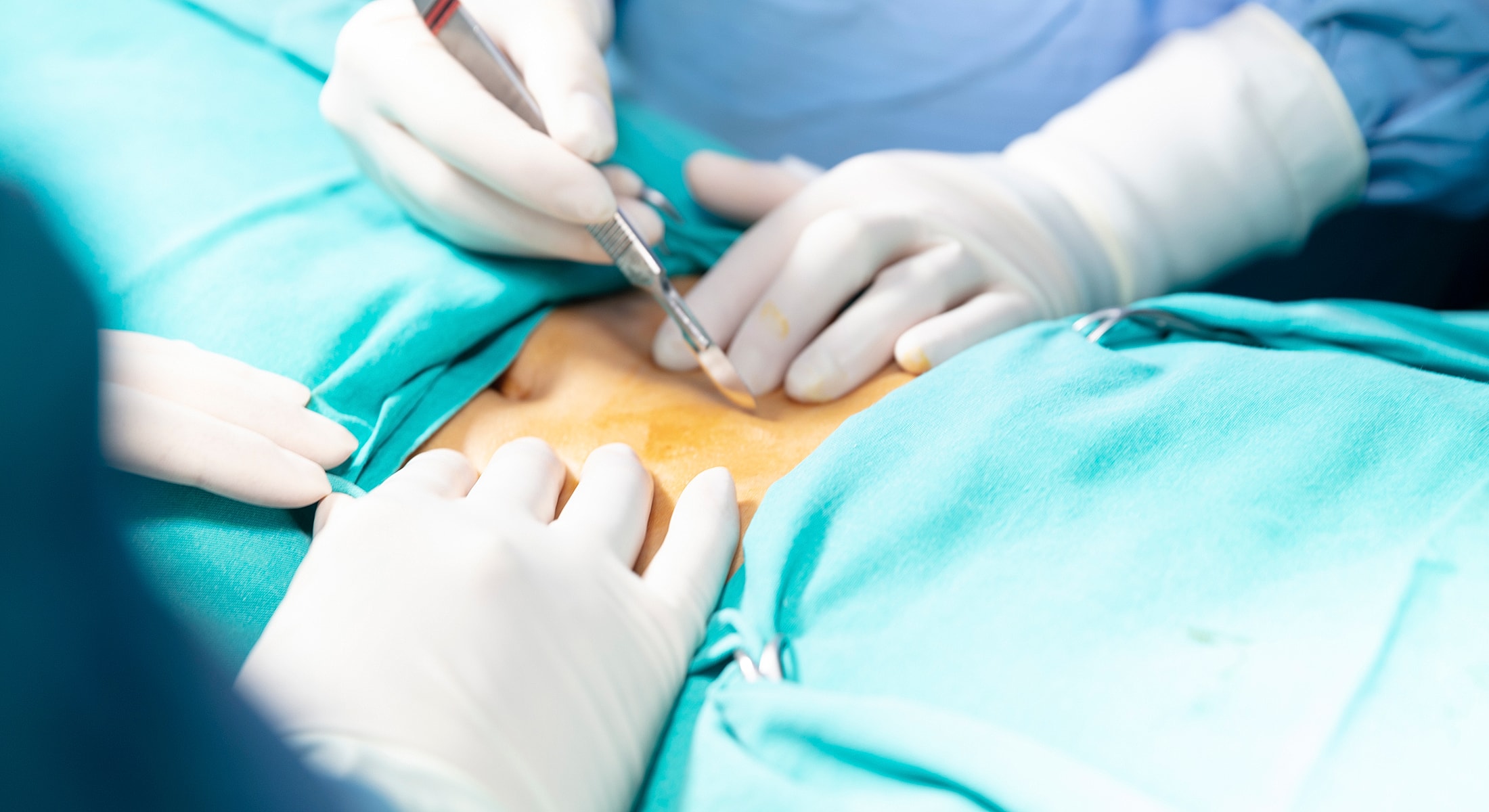 Surgeons performing a medical procedure.